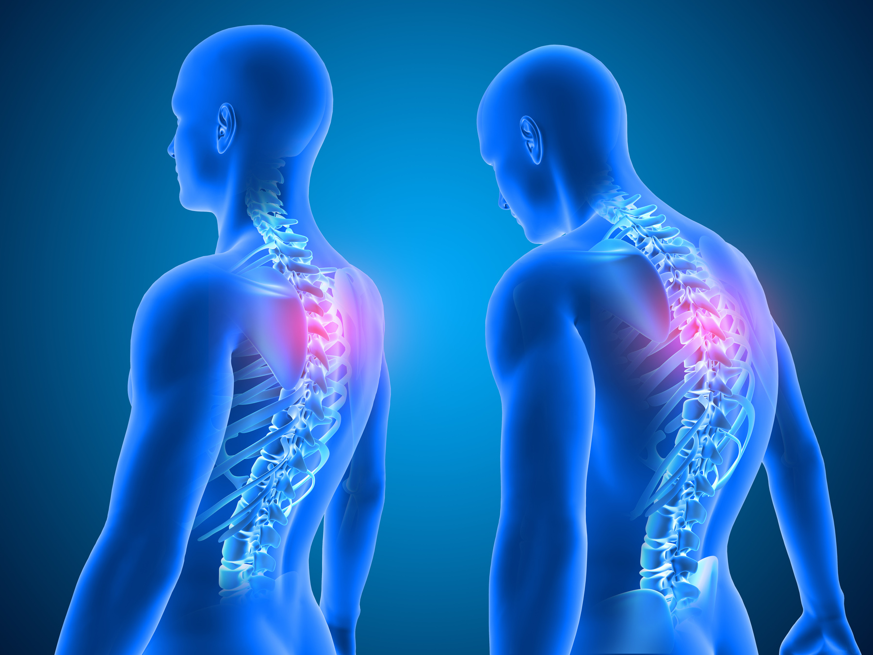 3D Render of the Difference between Good and Bad Posture 